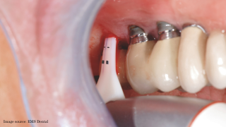 Image source: EMS Dental