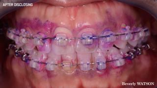 Jp Ortho Case 2