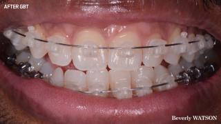 JP Ortho case3